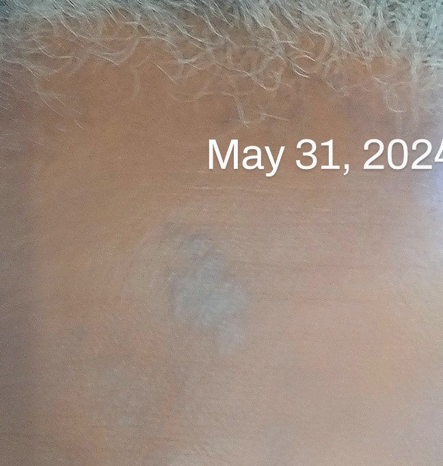 Blemish Me Not! 1oz.